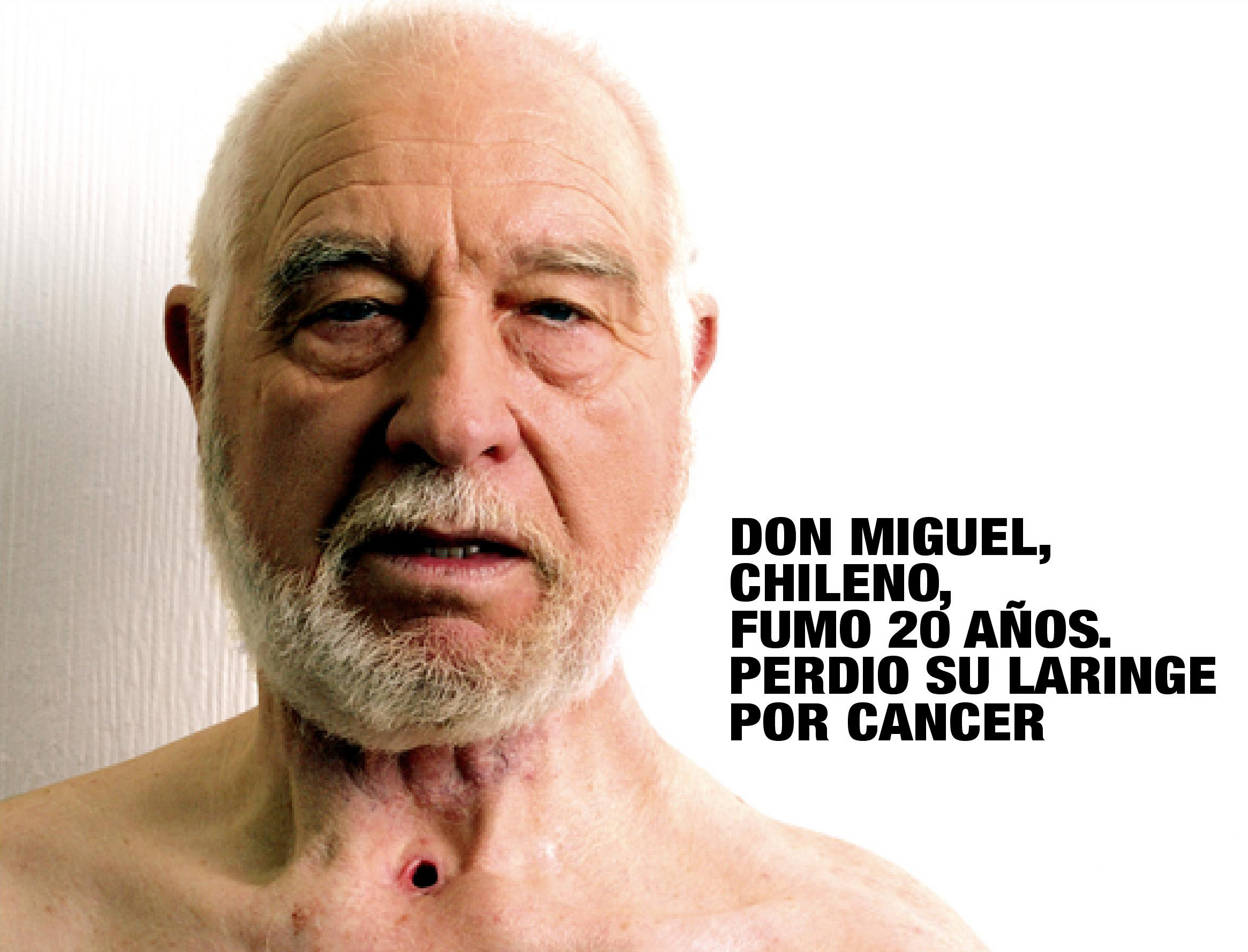 Chile 2006 Health Effects other - lived experience, cancer of larynx